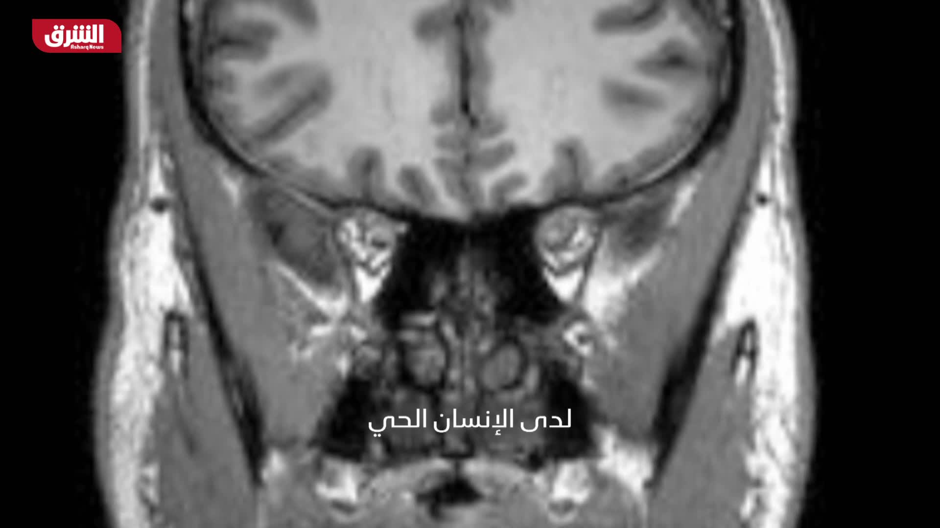 العمر المديد - لغز الدماغ